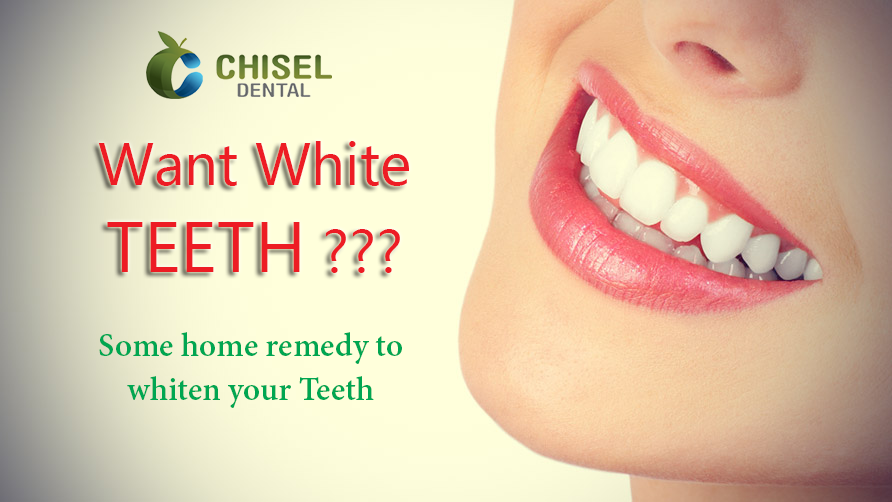 Whiten-Your-Teeth